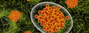 cancer cells