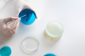 Eine Person mit Handschuhen hält eine Petrischale mit blauer Nährlösung und arbeitet mit einem Inokulationsstab. Auf dem Tisch liegen weitere Petrischalen mit unterschiedlichen Proben – eine typische Laborszene aus der Mikrobiologie.