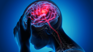 A man suffering of headaches