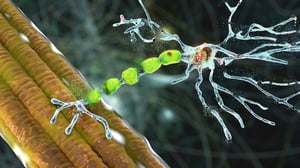 motor-neurons-degradation