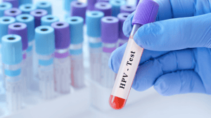 Medico che tiene in mano una provetta con campione di sangue per il test HPV sullo sfondo di provette mediche con analisi.