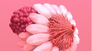 cancro al seno
